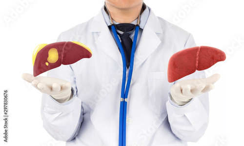 doctor touch fatty on liver , concept fatty liver 