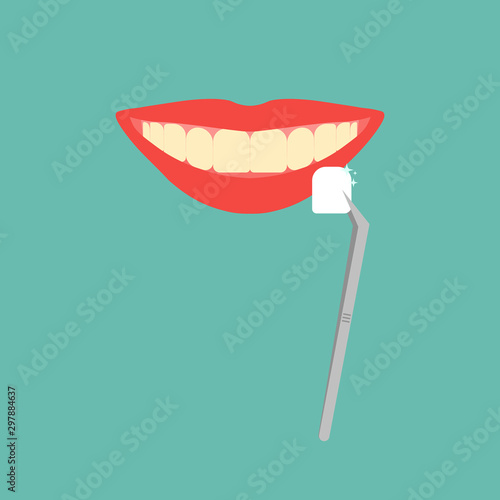 Dental veneers on a human tooth. Cartoon teeth .Stock vector illustration.Concept dentistry clinic.Dental care equipment sign, medical elements. Health care symbol
