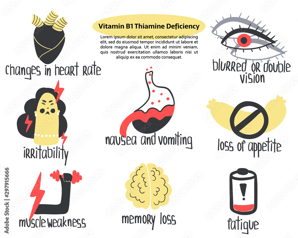 Vecteur Stock Hand drawn vitamin B1 thiamine deficiency loss of