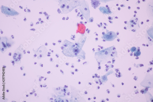 View in microscopic of normal human cervix cells with free space background.Squamous metaplasia cell lining of vagina in pap smear slide.Cytology and pathology laboratory