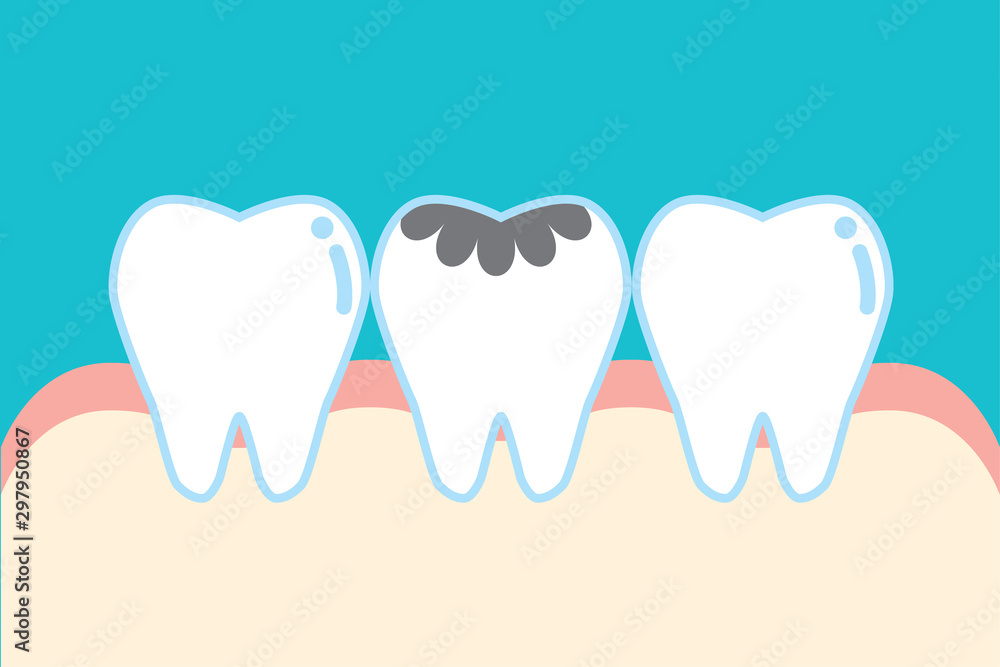 虫歯のかわいい歯のイラスト Cute Cartoon Decayed Tooth Illustration Stock ベクター Adobe Stock