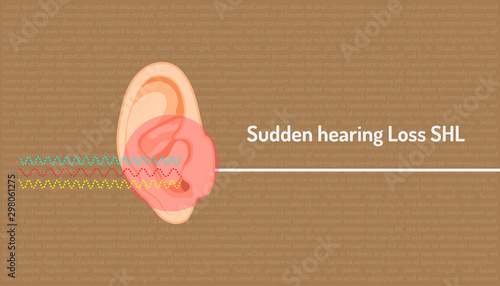 sudden hearing loss shl red dangerous clircle symbol mean a signal is wave line into an ear but can not hear  is direct line. body part beautiful color. vector illustration eps10