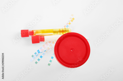 Laboratory ware with urine samples for analysis on white background, top view