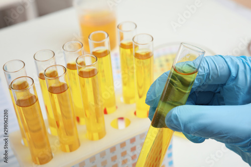 Εκτύπωση καμβά Doctor holding test tube with urine sample for analysis, closeup