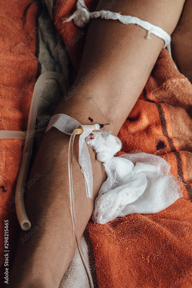 Obraz premium Hand of a patient with medical drip in hospital. Patient with drip receiving a saline solution. patient lying on bed in hospital.