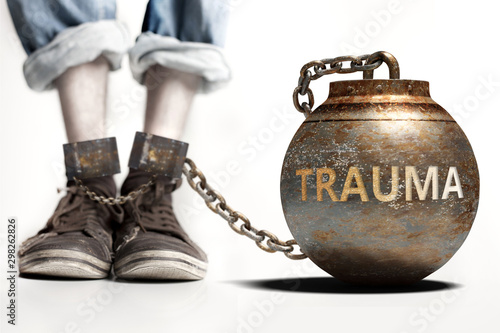 Trauma can be a big weight and a burden with negative influence - Trauma role and impact symbolized by a heavy prisoner's weight attached to a person, 3d illustration
