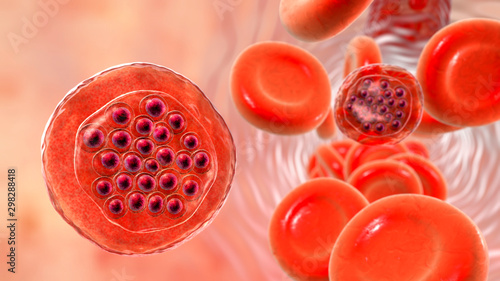 The malaria-infected red blood cells. 3D illustration showing parasite Plasmodium falciparum in schizont stage inside red blood cells, the causative agent of tropical malaria