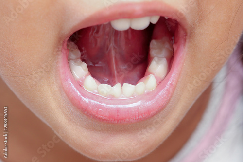 Conceptual image of periodic checking in children to detect tooth caries
