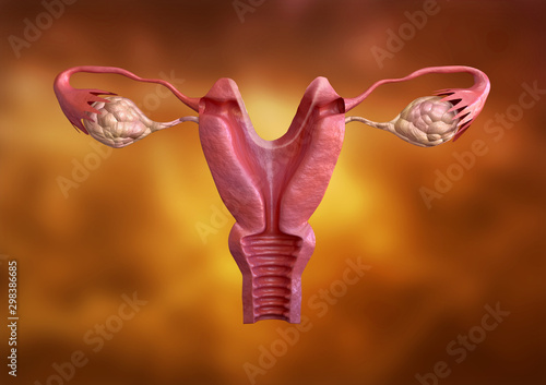 Tableau sur toile uterine malformation