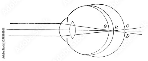The Position of the Retina in Near and Far Sight, vintage illustration.