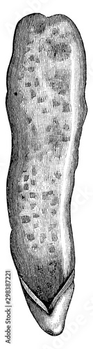 Internal Surface of the Appendix, vintage illustration.
