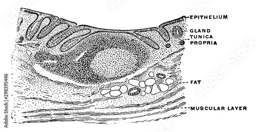 Transverse Section of Appendix, vintage illustration.