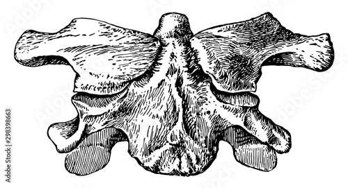 Atlas Without Anterior Arch, vintage illustration.