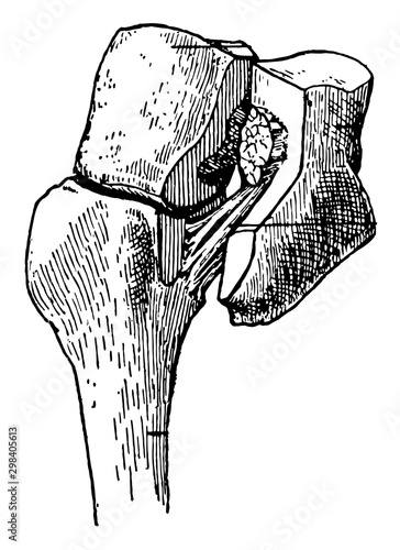 Ligament of Lisfranc, vintage illustration.