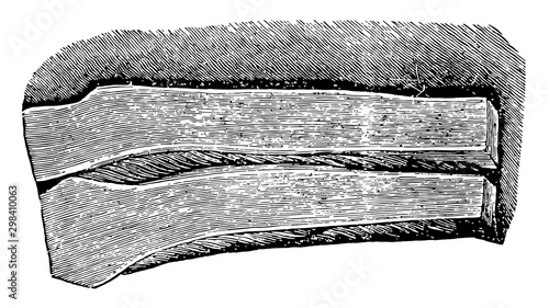 Cartilage Portion in Section, vintage illustration.