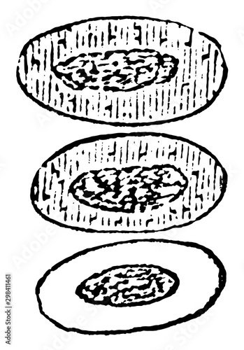 Effect of Acetic Acid on Red Blood Cells, vintage illustration photo