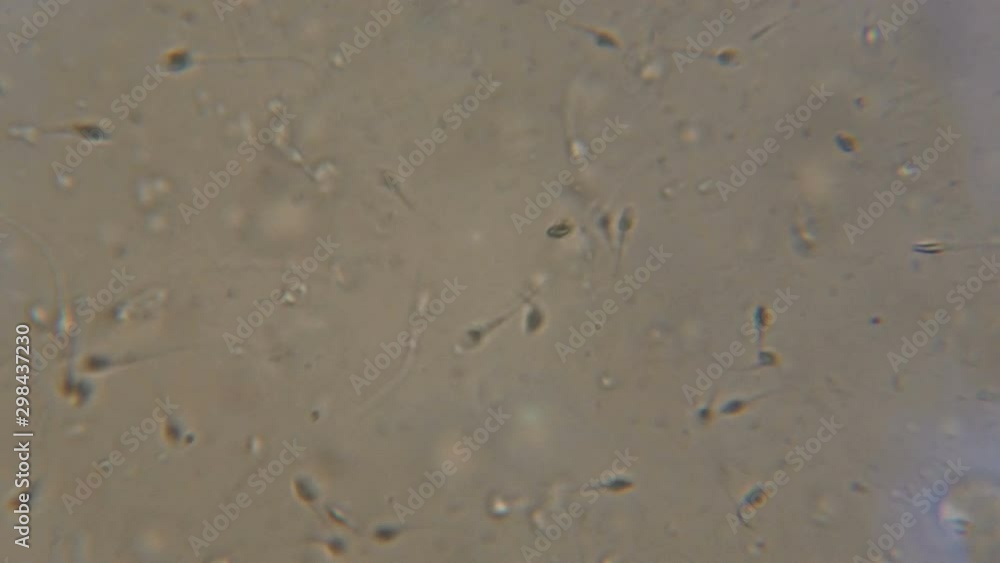 Sperm (spermatozoa) viewed under the microscope. Moving human sperm under Phase contrast Microscope. Close up showing spermatozoons. Video semen under microscope. 4K UHD Sperm (spermatozoa) viewed under the microscope. Moving human sperm under Phase contrast Microscope. Close up showing spermatozoons. Video semen under microscope. 4K UHD