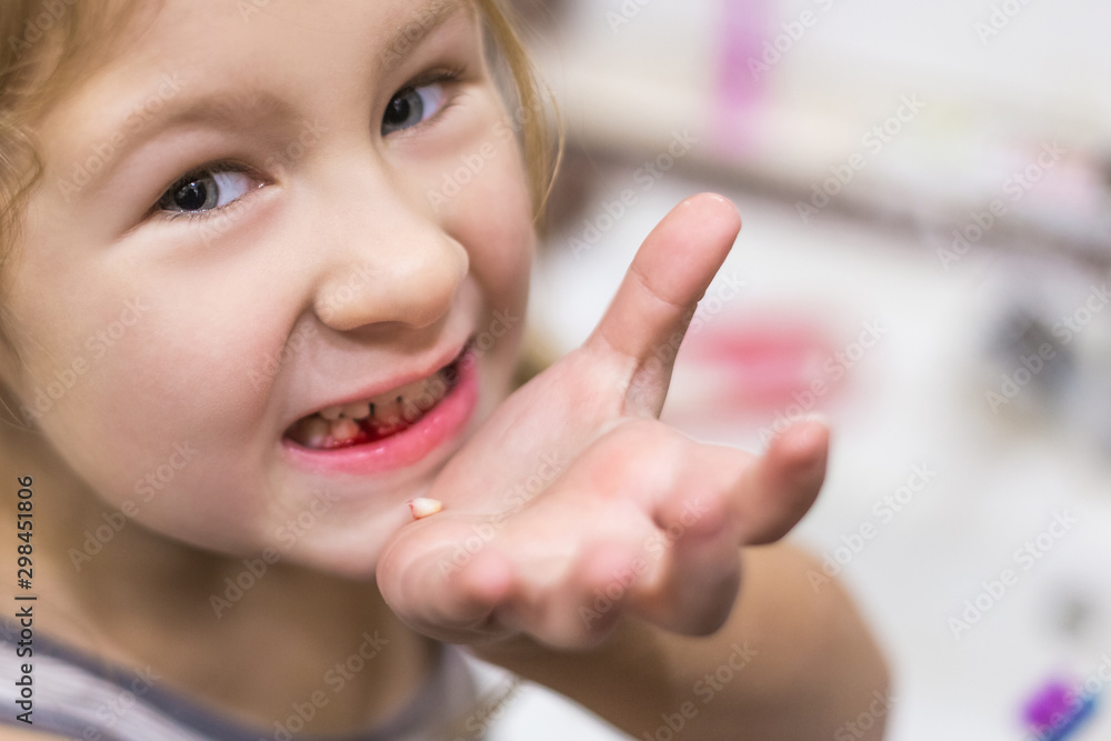 Cute little child has just lost the first milk tooth. Cute little child has just lost the first milk tooth.