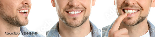 Man with healthy teeth on white background, closeup