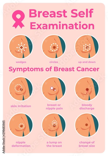 Breast cancer exam. Infographic of oncology tumor symptoms, cartoon young girl self examination. Vector diagnosis instructions to inspection woman mammography