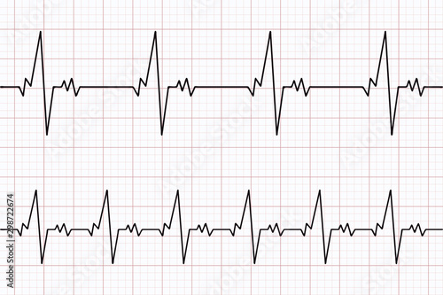 Heartbeats cardiogram. ECG heart line. Electrocardiogram paper background. Vector illustration.