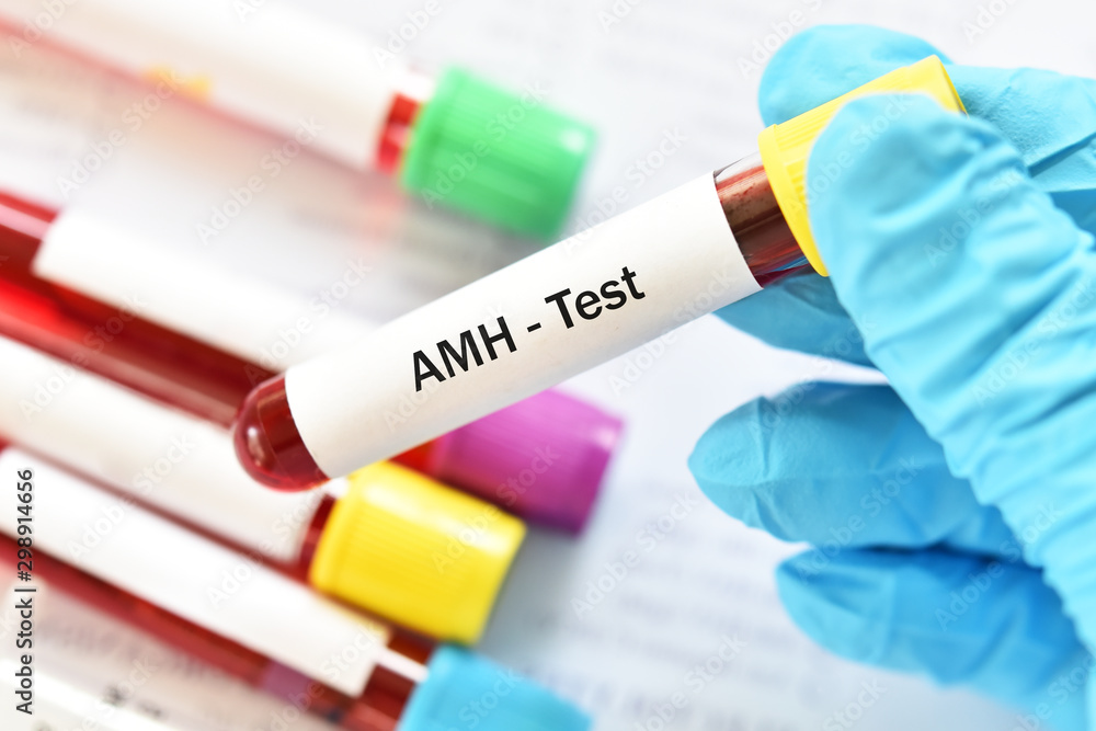 Blood sample tube for anti-Müllerian hormone or AMH test, evaluate of ...