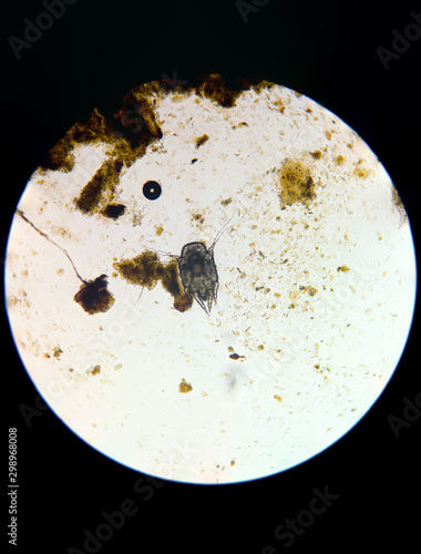 otodectes cynotis also known as ear mite. Taken from ear of homeless cat.