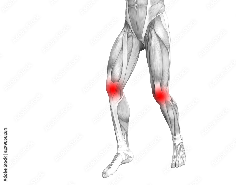 Conceptual knee human anatomy with red hot spot inflammation or articular joint pain for leg health care therapy or sport muscle concepts. 3D illustration man arthritis or bone osteoporosis disease Conceptual knee human anatomy with red hot spot inflammation or articular joint pain for leg health care therapy or sport muscle concepts. 3D illustration man arthritis or bone osteoporosis disease
