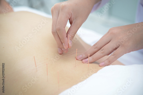 Closeup, patient getting acupuncture from acupuncturist at clinic for chinese medicine treatment.