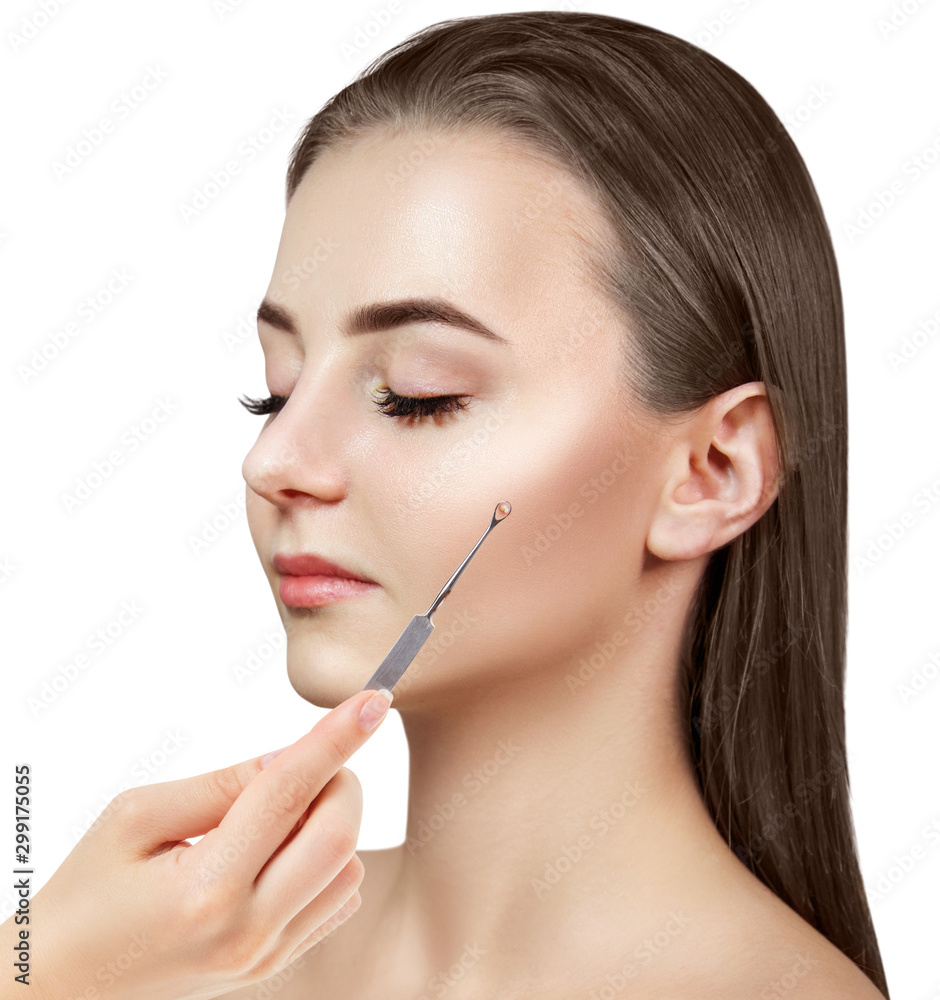Mechanical cleaning of young female face with acne loop Mechanical cleaning of young female face with acne loop
