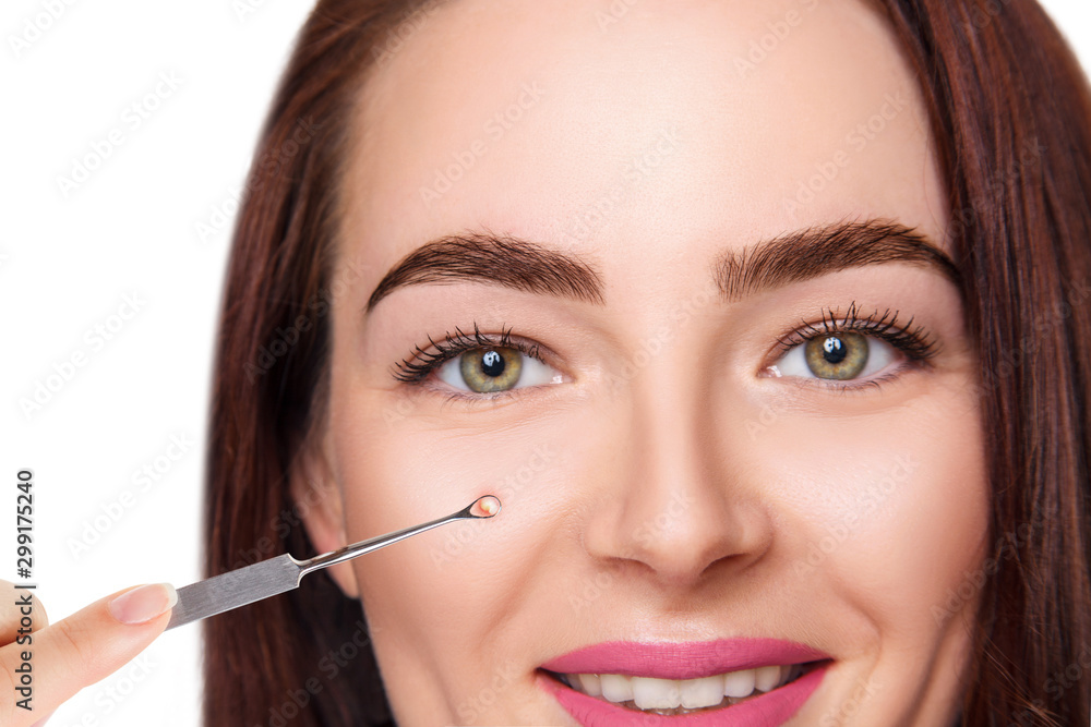 Mechanical cleaning of young female face with acne loop Mechanical cleaning of young female face with acne loop