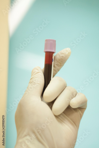 Hand with blood