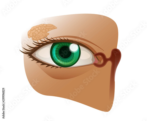 Illistration of the human eye with the lacrimal gland photo