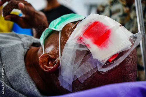 Head injury patients in Emergency Room after the accident.