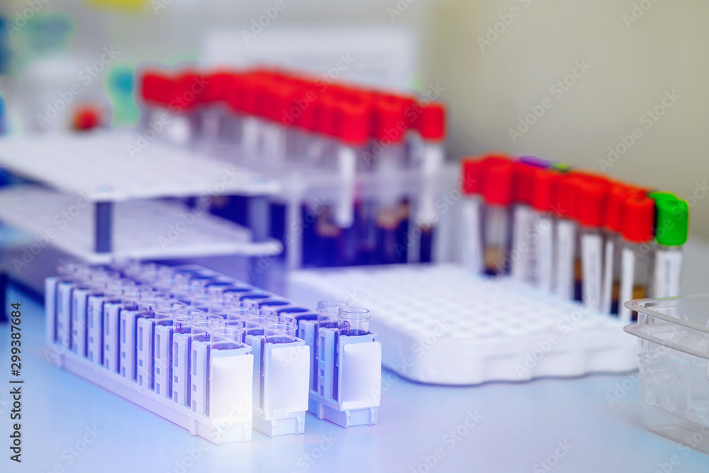 Tubes of blood sample for testing in laboratory. Rack of flasks in laboratory for testing. Biological material, Health care concept. Closeup.