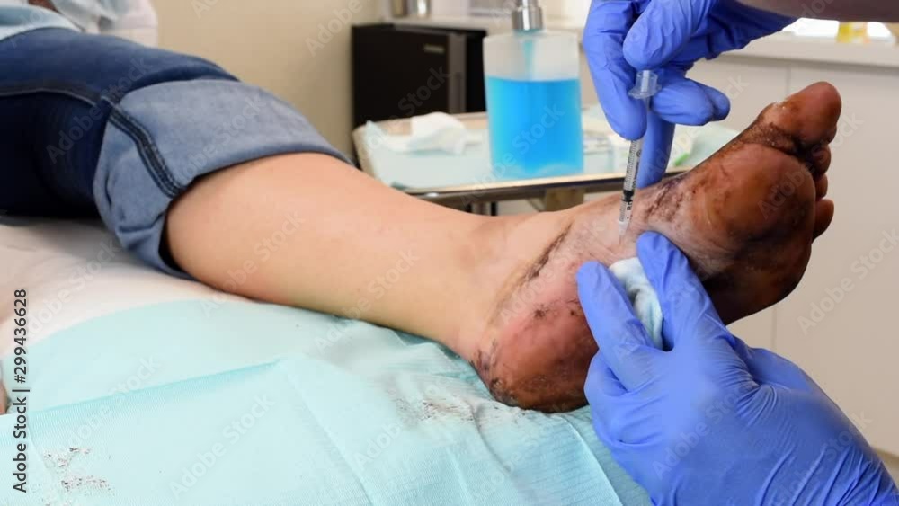Cinematic view of a dermatology procedure with botox Cinematic view of a dermatology procedure with botox