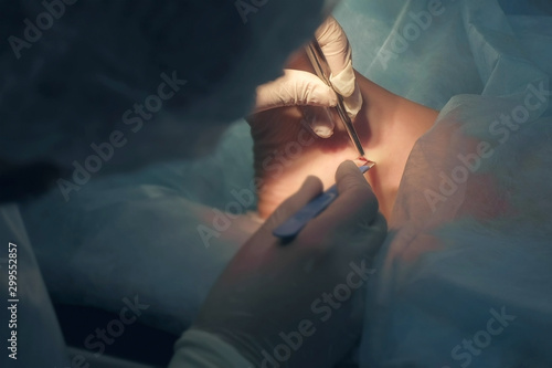 фотографія Surgeon makes an incision with scalpel on leg on ankle to remove joint hygroma in operating room in hospital