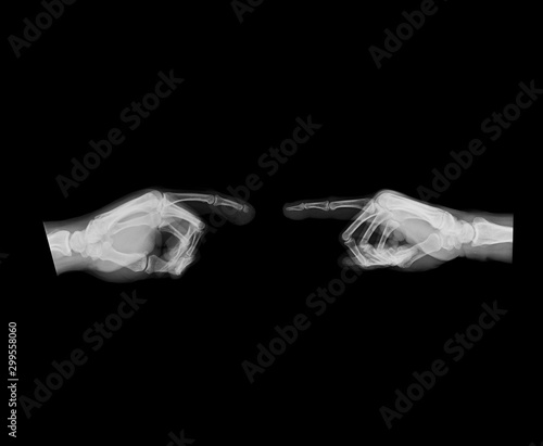 Φωτογραφία X-ray image of two hands using index finger pointing each other