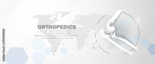 Medical orthopedic abstract background. Treatment for orthopedics traumatology of elbow bones and joints injury. Medical presentation, hospital. Vector illustration	
