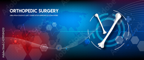Medical orthopedic abstract background. Treatment for orthopedics traumatology of humerus bones and joints injury. Medical presentation, hospital. Vector illustration	