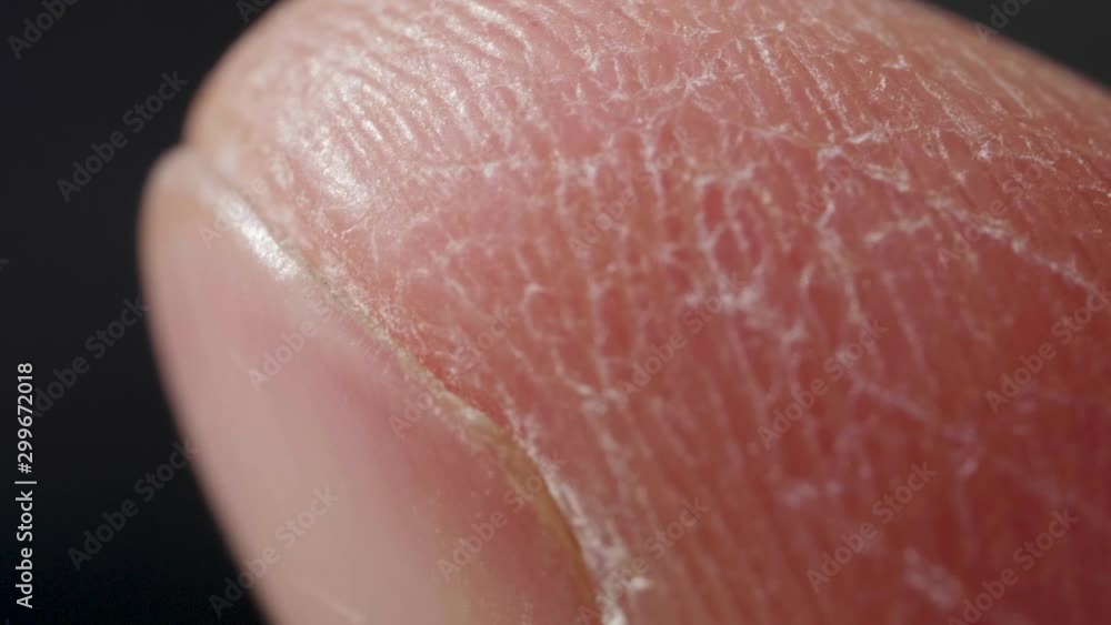 Detailed finger of white caucasian person in macro Detailed finger of white caucasian person in macro