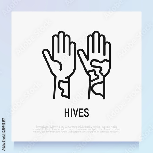 Hives on hand thin line icon. Allergy symptom. Modern vector illustration of allergic reaction.