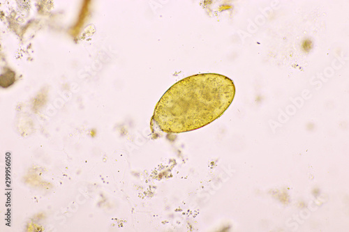 Egg of intestinal fluke in human stool, analyze by microscope, original magnification 400x photo