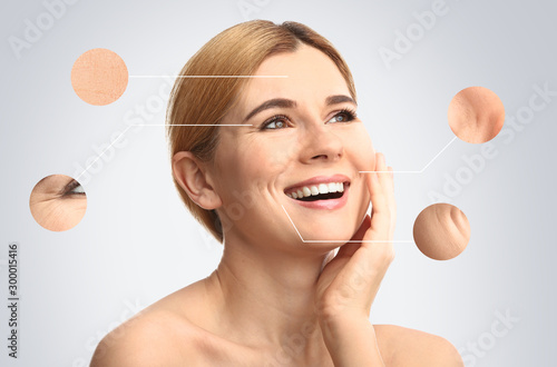 Portrait of beautiful woman with skin problem on light background. Process of aging