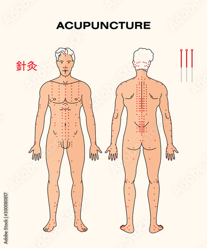 ACUPUNCTURE on human body