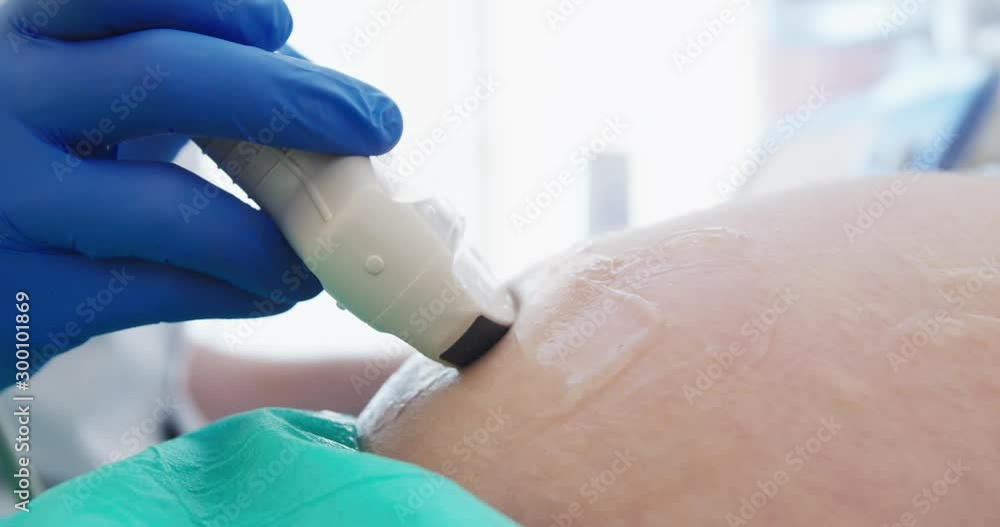 Hand held shot during a Sonogram / Ultrasound Screening / Scan exam. Pregnant Woman. Close-Up of belly with gel Hand held shot during a Sonogram / Ultrasound Screening / Scan exam. Pregnant Woman. Close-Up of belly with gel