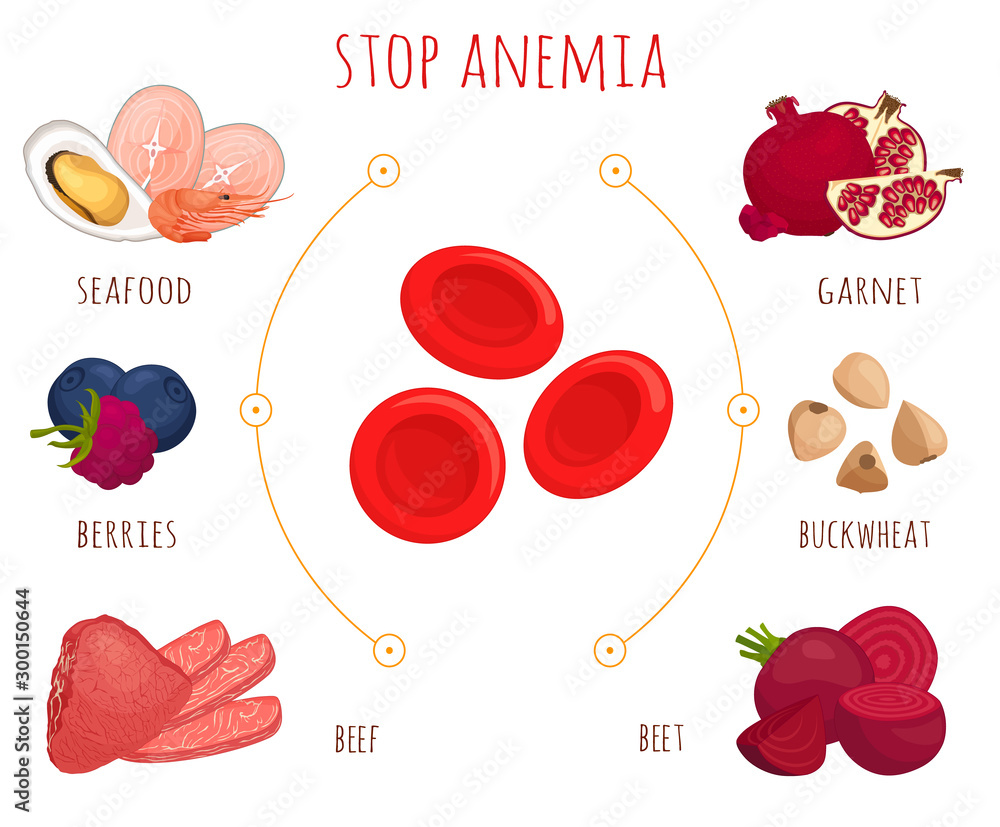 Foods Rich In Infographics On The Topic Of Anemia And Ferum