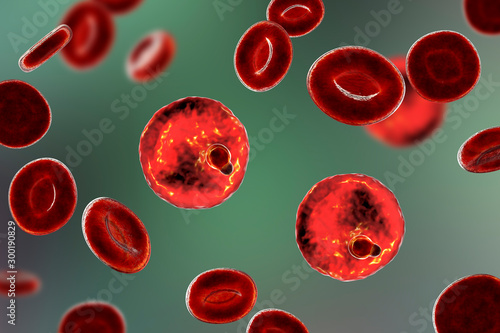 The malaria-infected red blood cell