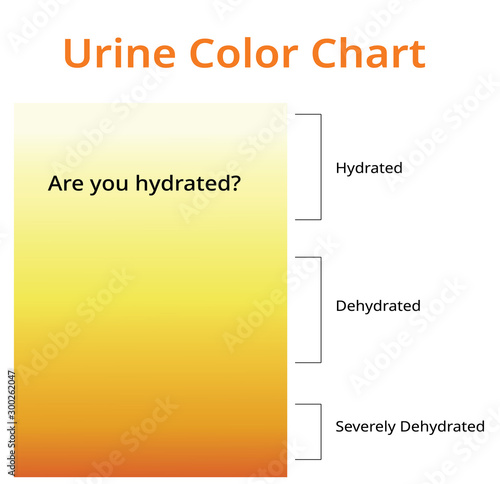 Urine color chart, Urine in Test tubes, Medical vector