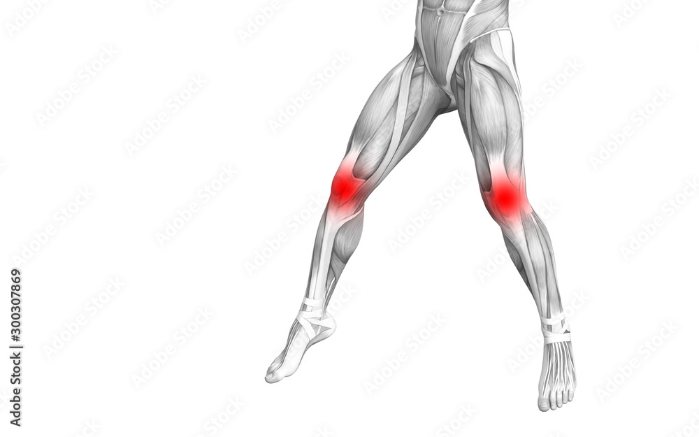 Conceptual knee human anatomy with red hot spot inflammation or articular joint pain for leg health care therapy or sport muscle concepts. 3D illustration man arthritis or bone osteoporosis disease Conceptual knee human anatomy with red hot spot inflammation or articular joint pain for leg health care therapy or sport muscle concepts. 3D illustration man arthritis or bone osteoporosis disease